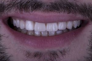 Estetică dentară