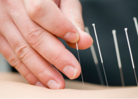 clinicile de acupunctura slabesc bucharest Clinica Qi